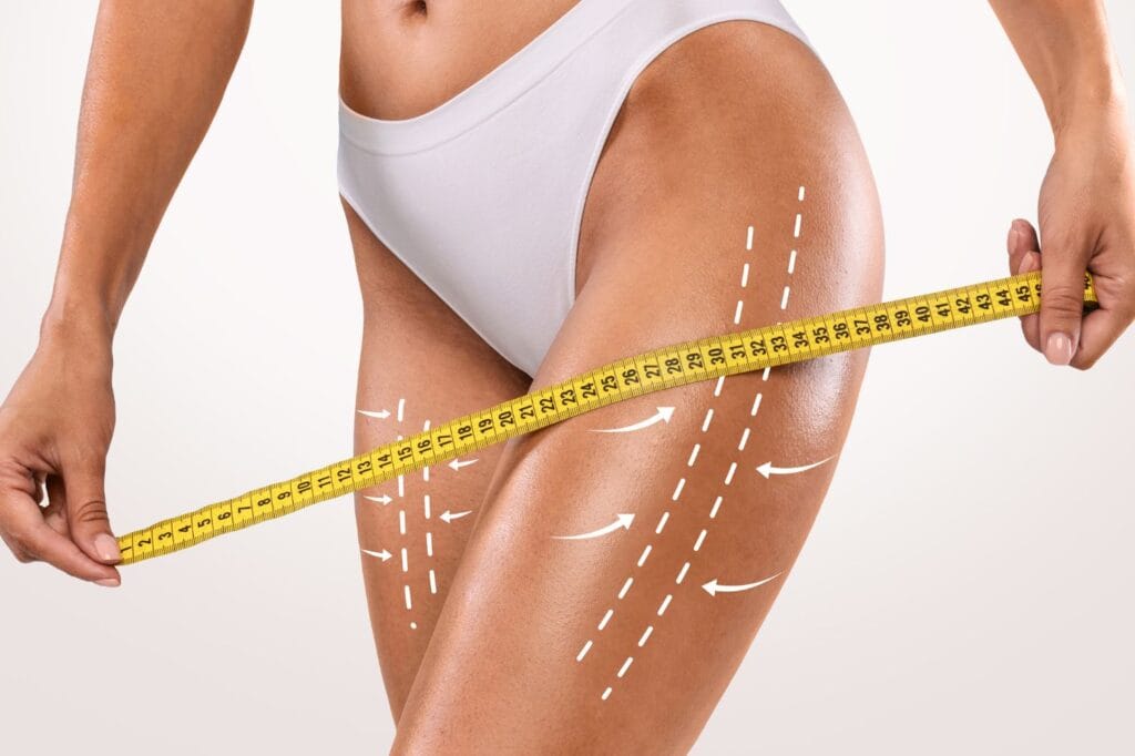 Lifting des cuisses