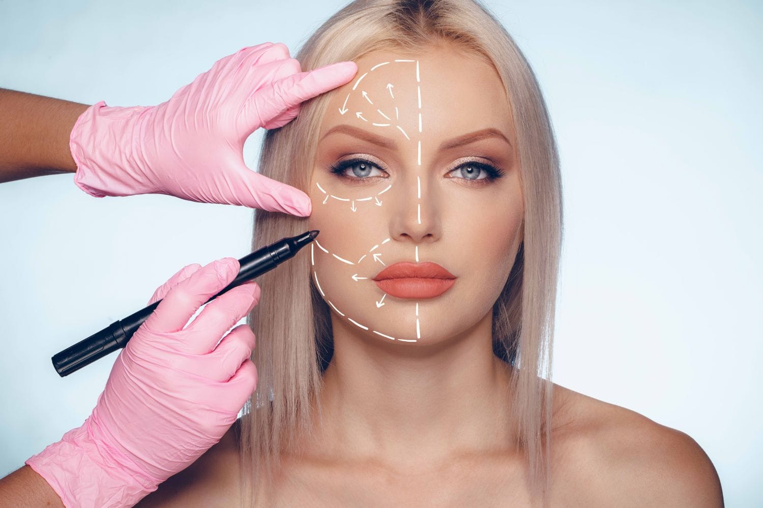 Lipofilling Visage