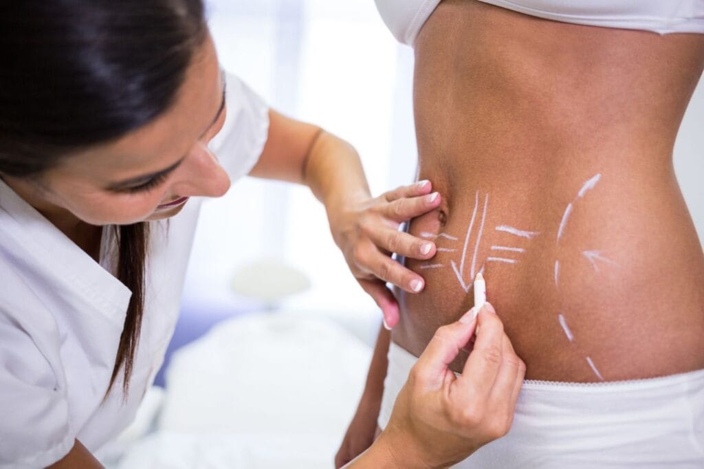 chirurgie de la silhouette